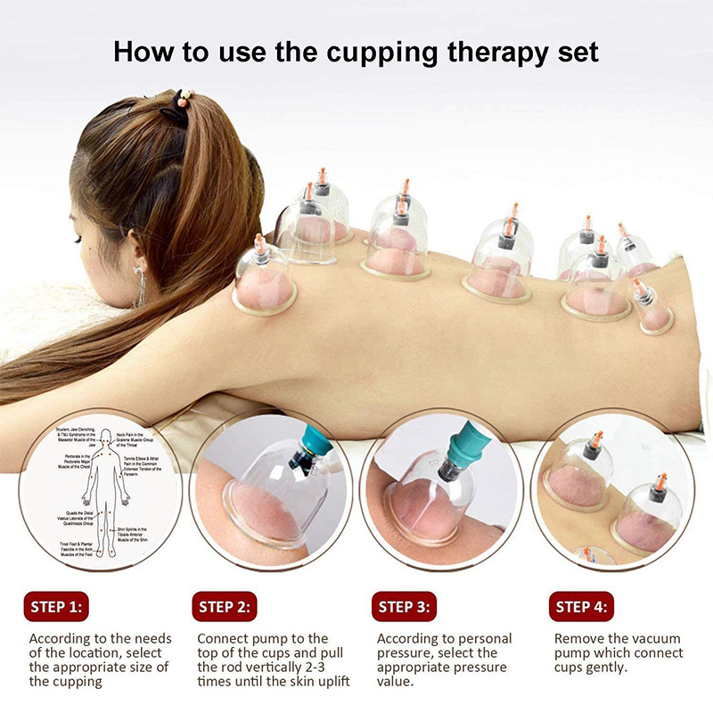 Mangkuk penyedot vakum pijat 6 - Cupping Therapy Set ulasan dan harga