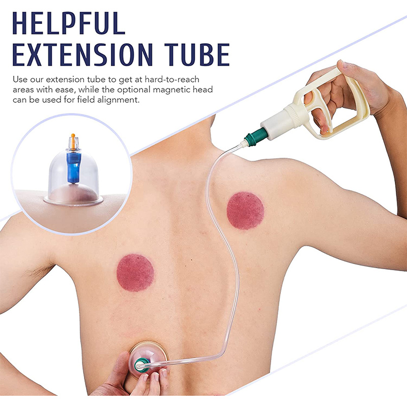 Mangkuk penyedot vakum pijat 6 - Cupping Therapy Set ulasan dan harga